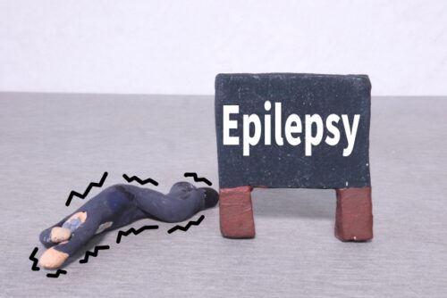 てんかん（epilepsy) 　